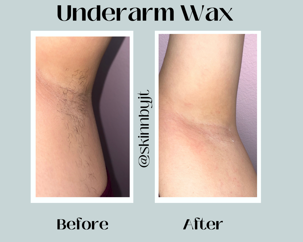 Underarm Wax