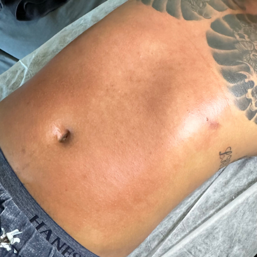 Men’s Stomach Wax at Sacred Essence Aesthetics in Memphis, TN