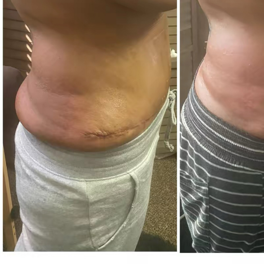 Lymphatic Drainage - 1 hour at 210 The Body Bar | San Antonio Lux Spray Tans & Body Sculpting in San Antonio, TX