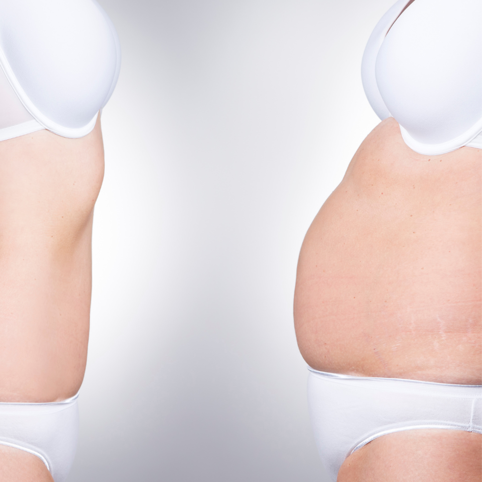 MICC Skinny Shot at Eden Rose Health and Wellness in Bridgeport, CT