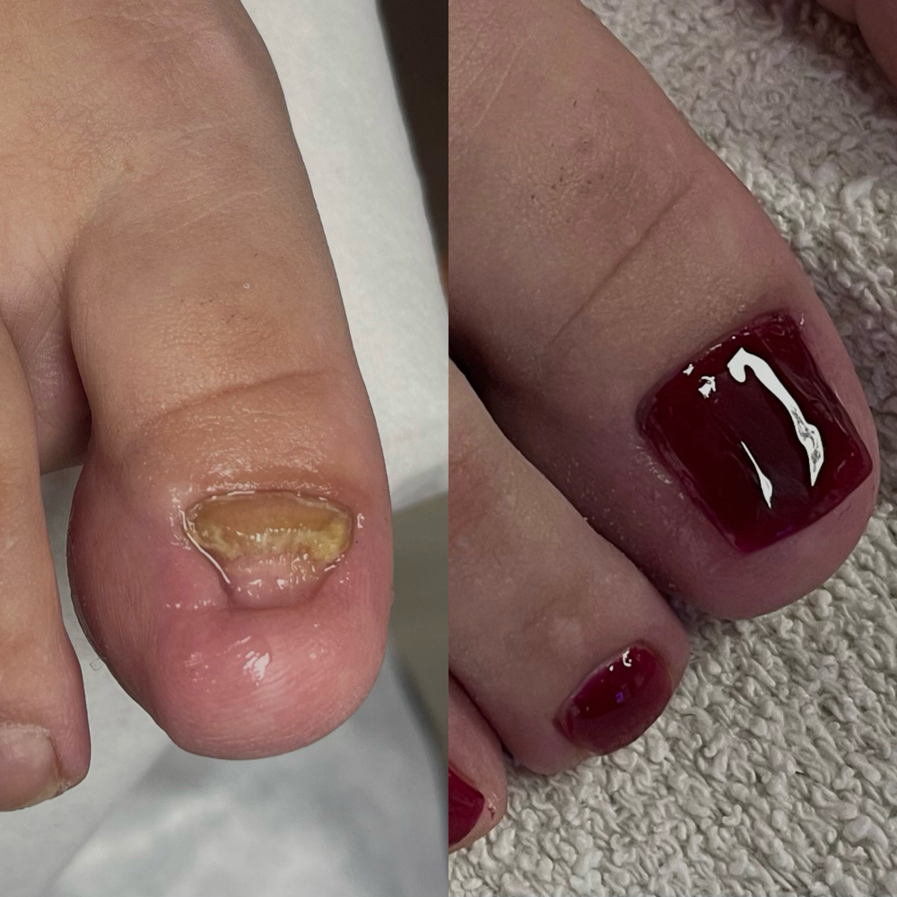 NanoFlex Pedi (Damaged Nails) at Beauty & Essence in Moreno Valley, CA