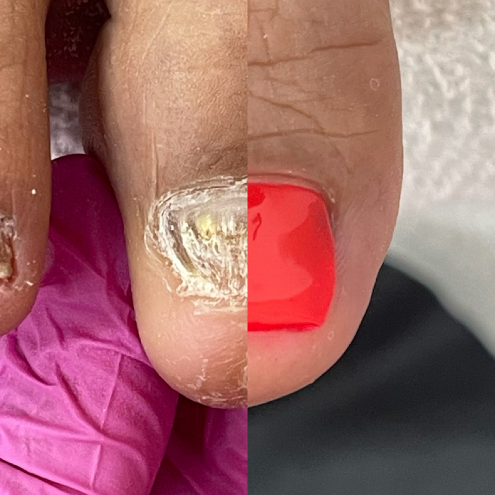 ADD ON: NanoFlex at Beauty & Essence in Moreno Valley, CA