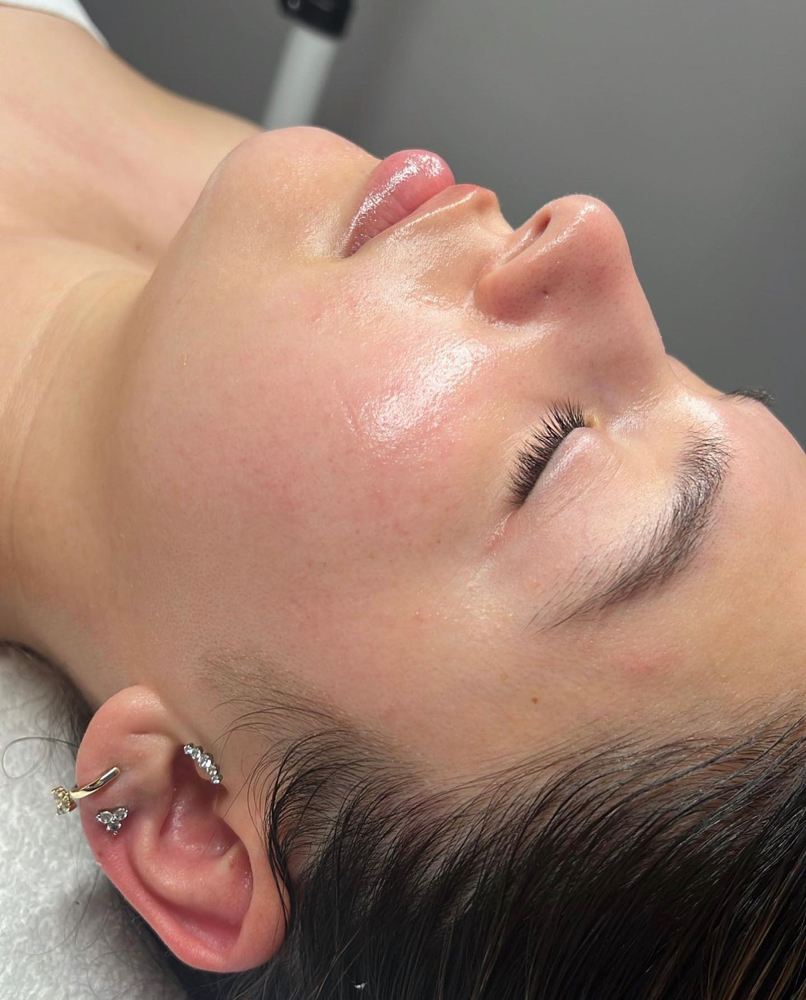 Dermaplane Facial