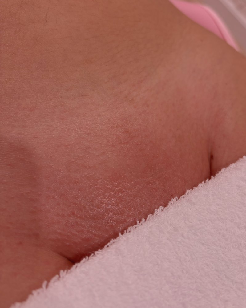 Brazilian Wax