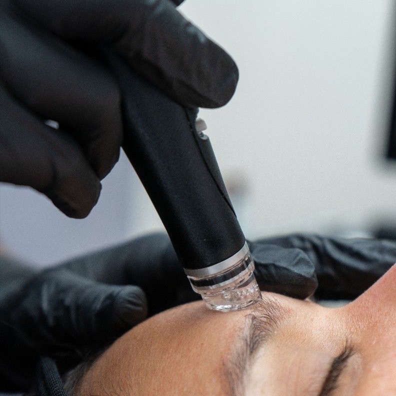 the signature hydrafacial at 828aesthetics in Henderson, NV