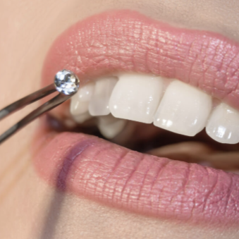 Tooth Gems at Emerald & Co. Beauty in Corpus Christi, TX