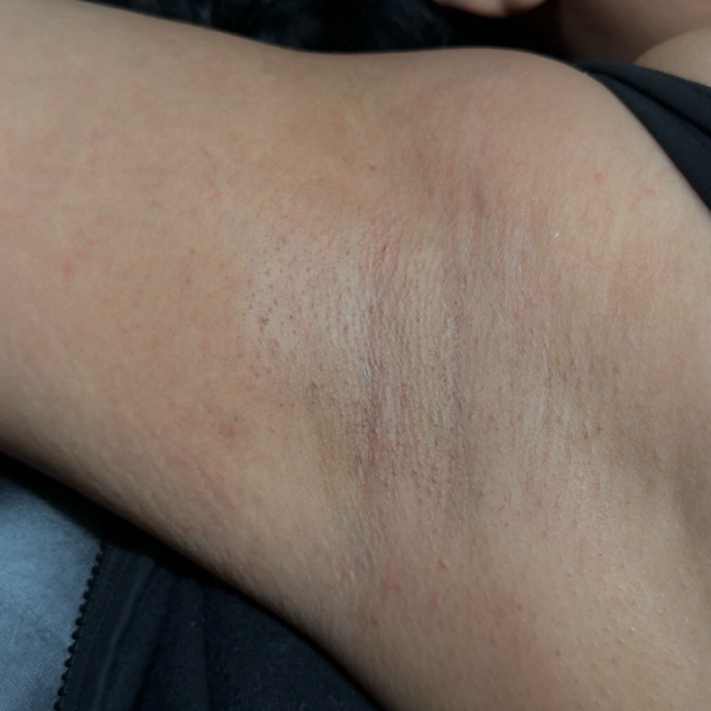 Underarm Wax at Belles Royal Spa in Weslaco, TX