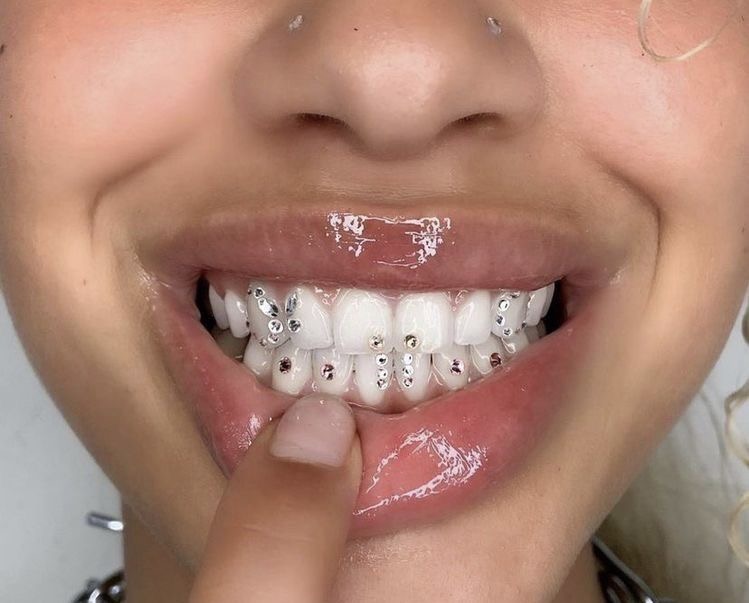 Tooth Gems