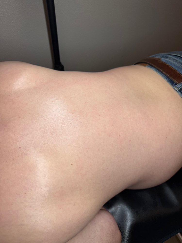 Back
