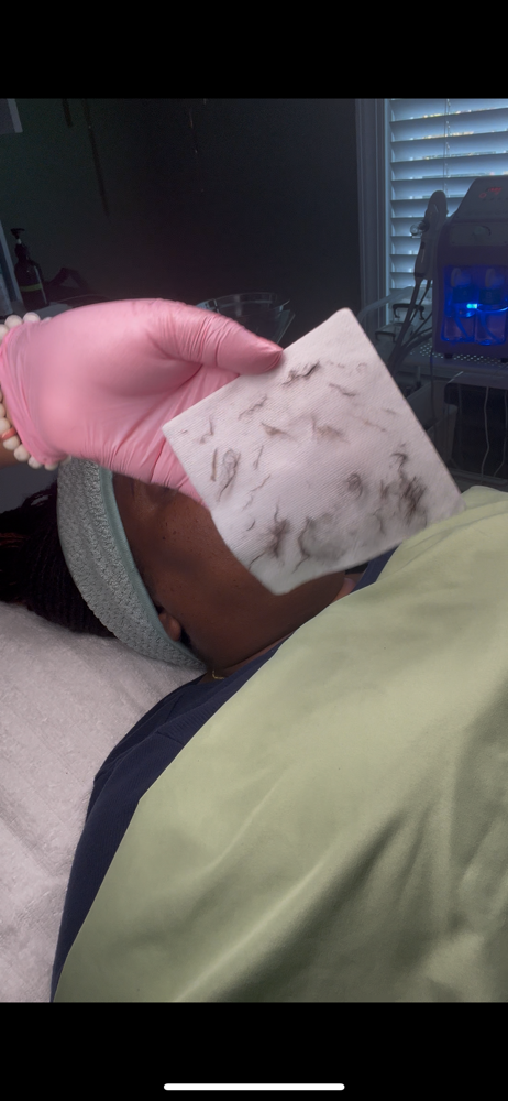 Dermaplane at Nani Esthetics By Dasia in Clayton, NC