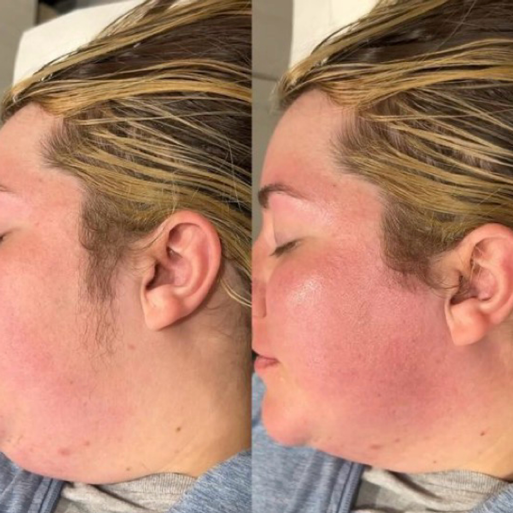 Facial Waxing: Sideburn at Nyah Simone Spa in Garden City, NY