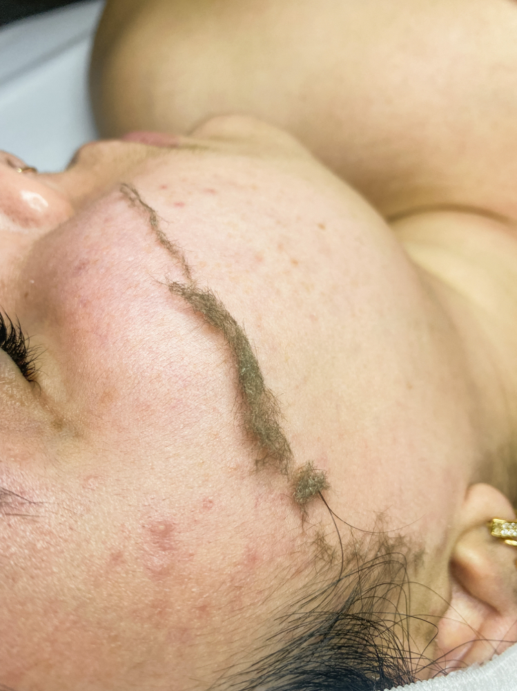 Dermaplaning (just by Itself)
