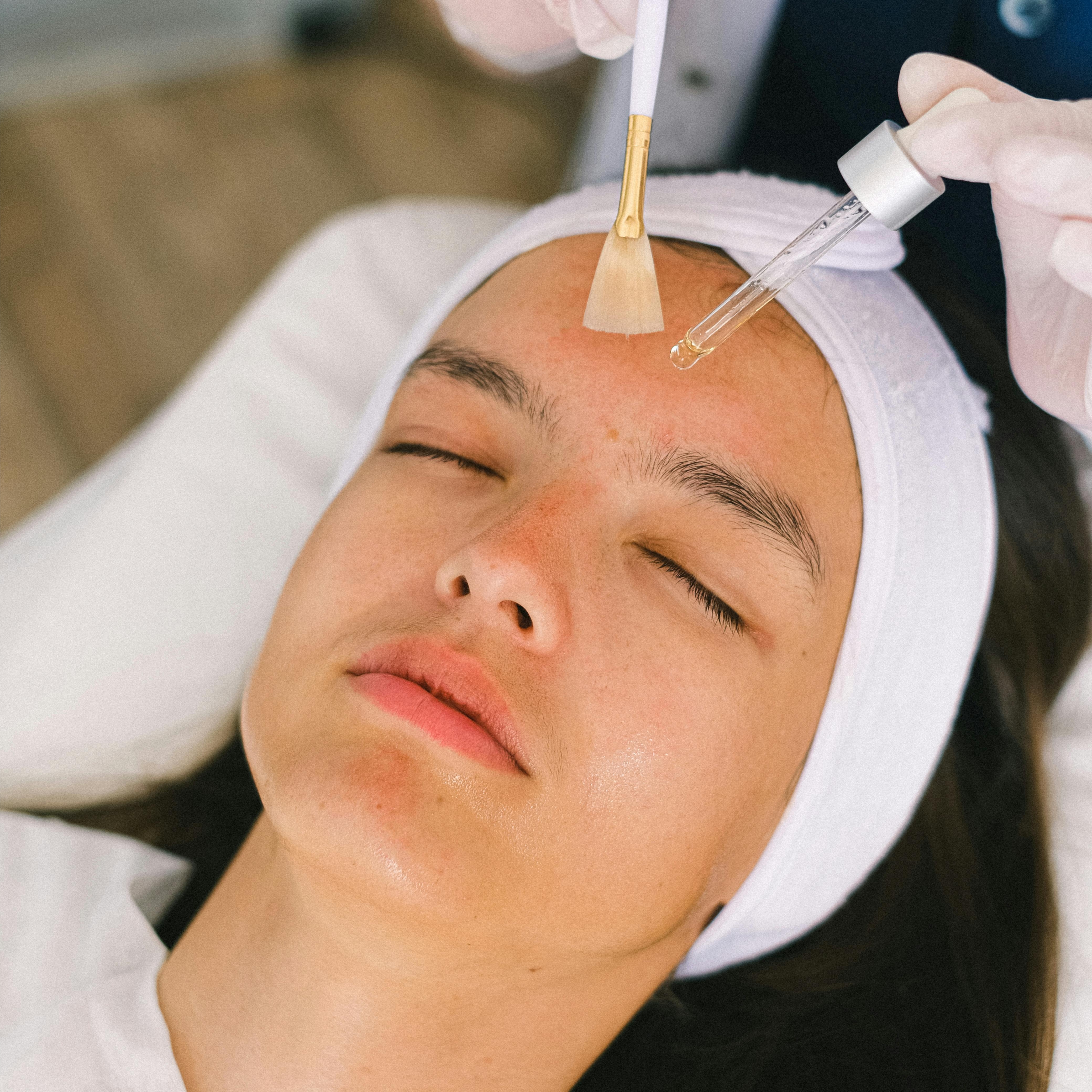 Micropeel at Elegant Bliss Skincare in Boulder, CO