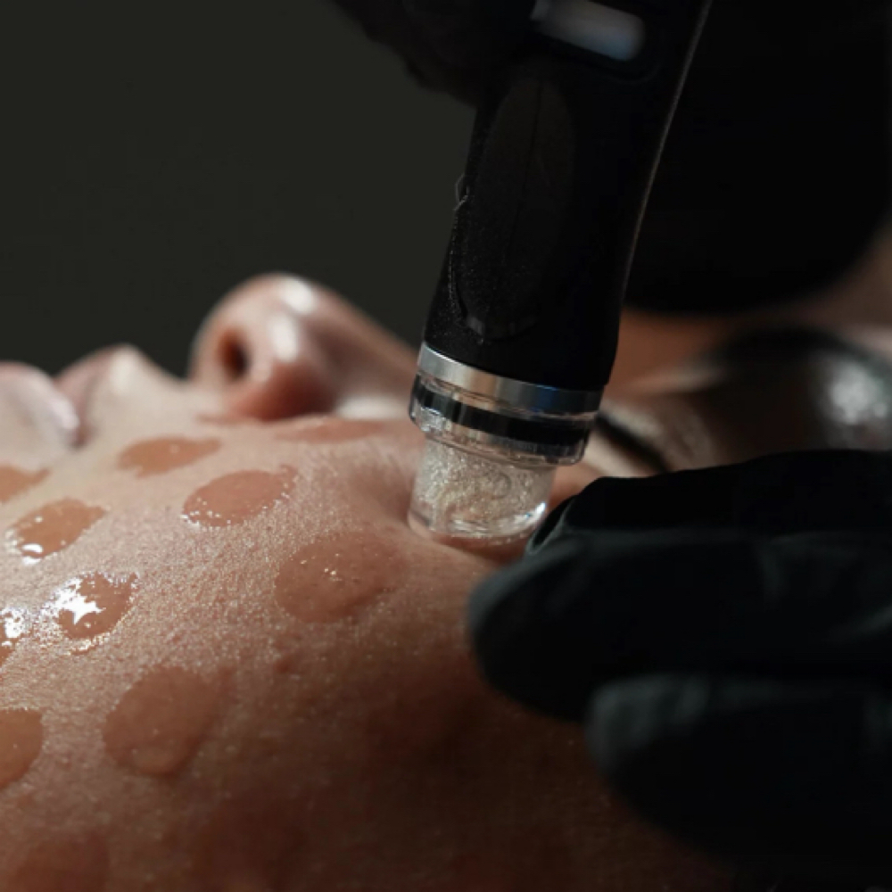 Signature Oxygen Renewal Facial at Rêvive in Lake Worth Beach, FL