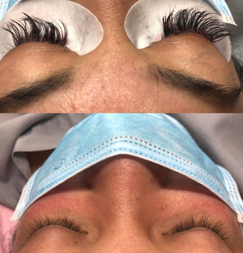 Lash Removal