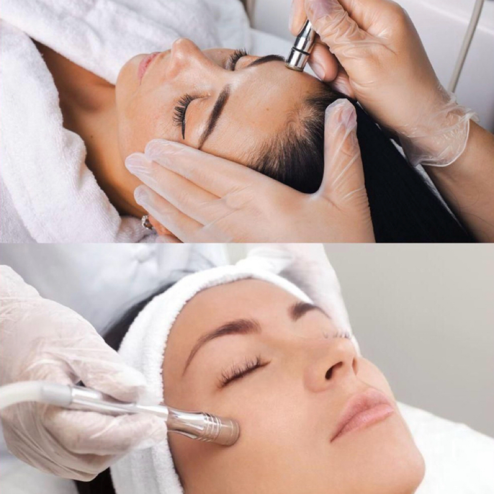 Microdermabrasion Facial at Wanderlust Aesthetics By Emily in Longview, TX