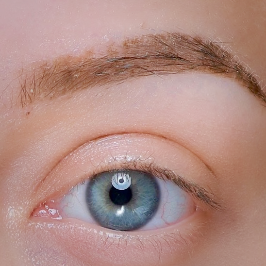 PIGMENT REMOVAL SALINE SOLUTION