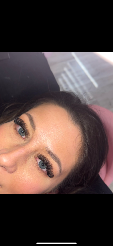 Volume Fill (2-3 Weeks)