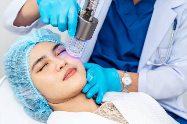 Picosure Laser Treatment