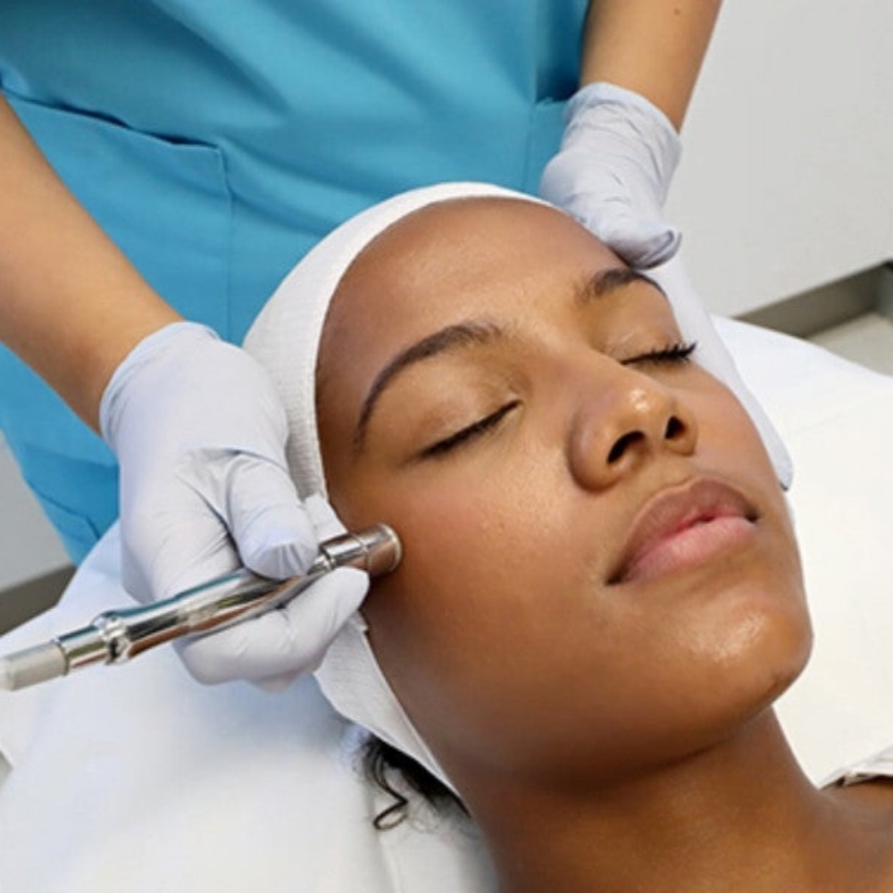 Microdermabrasion at Lotus Tranquility Spa in San Antonio, TX