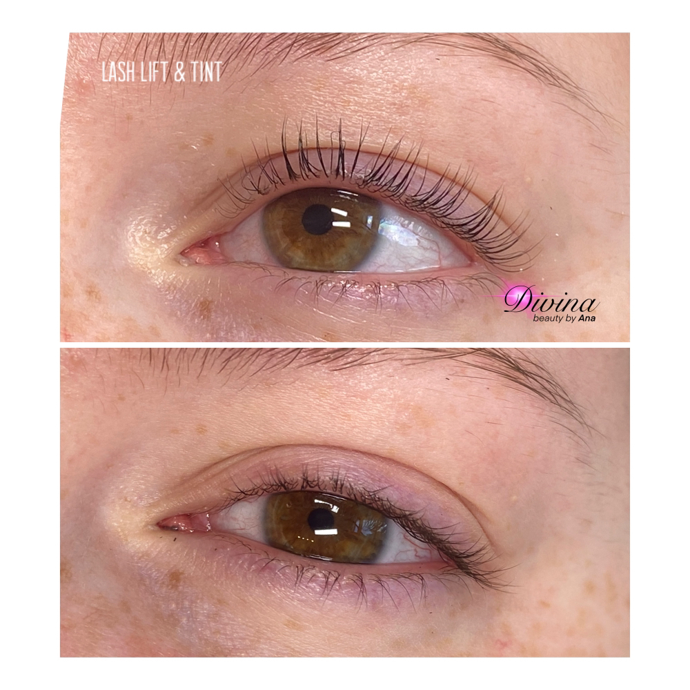 Lash Lift