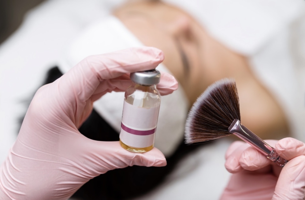 Chemical Peels