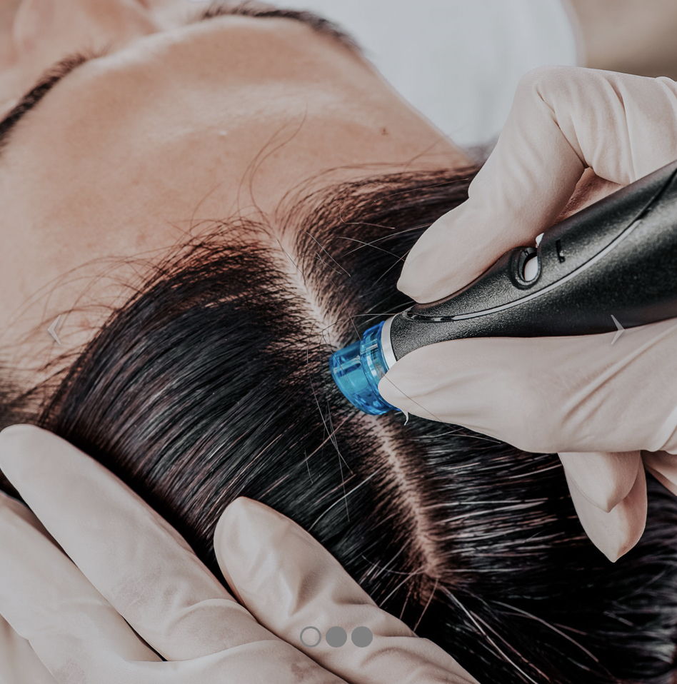 Hydro-dermabrasion Scalp Detox