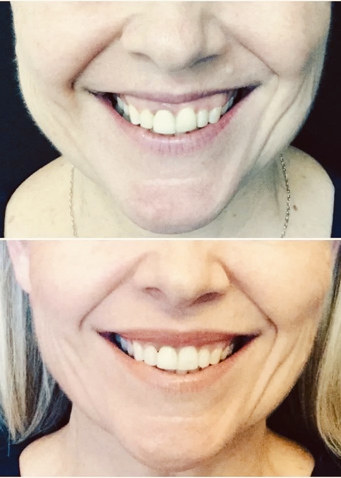 Lip Flip Friday in Wimberley