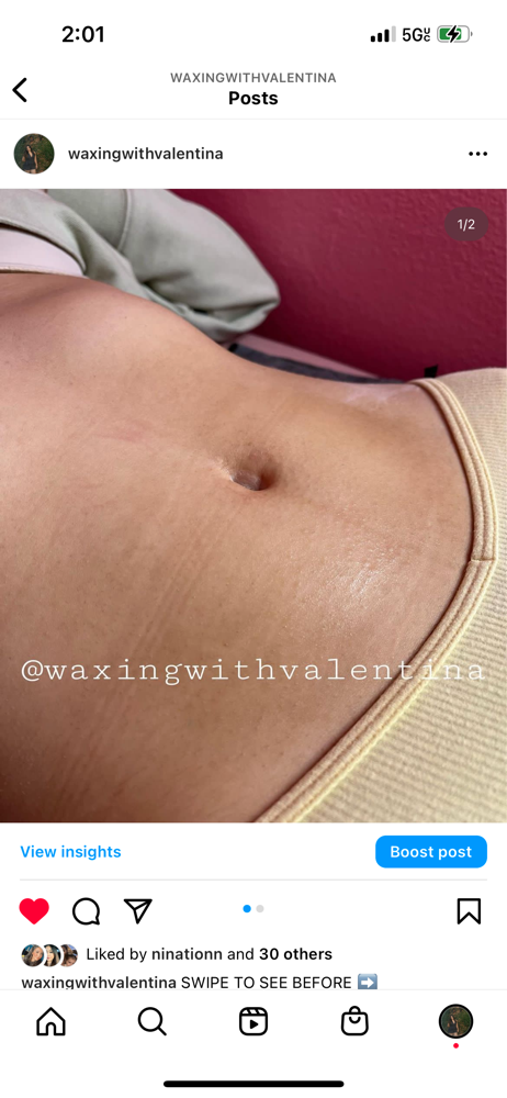 Full Stomach
