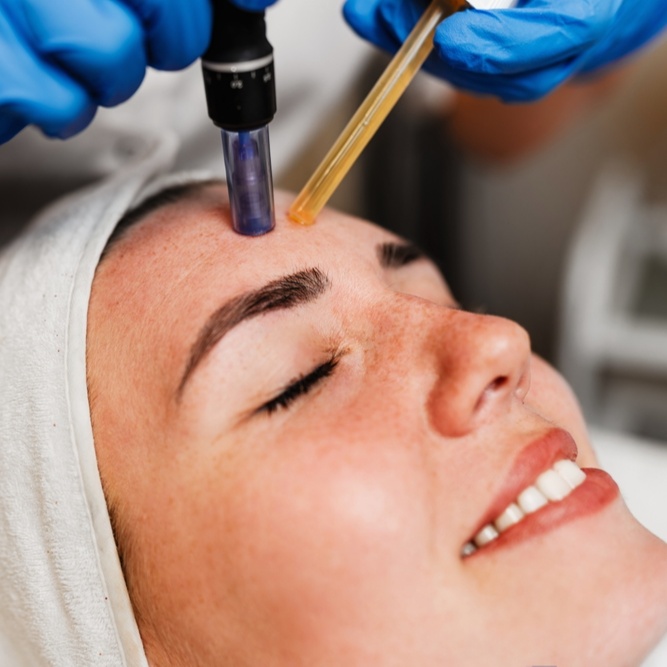 Microneedling Facial at Love It or Lose It Tattoo and Body Spa in Royse City, TX