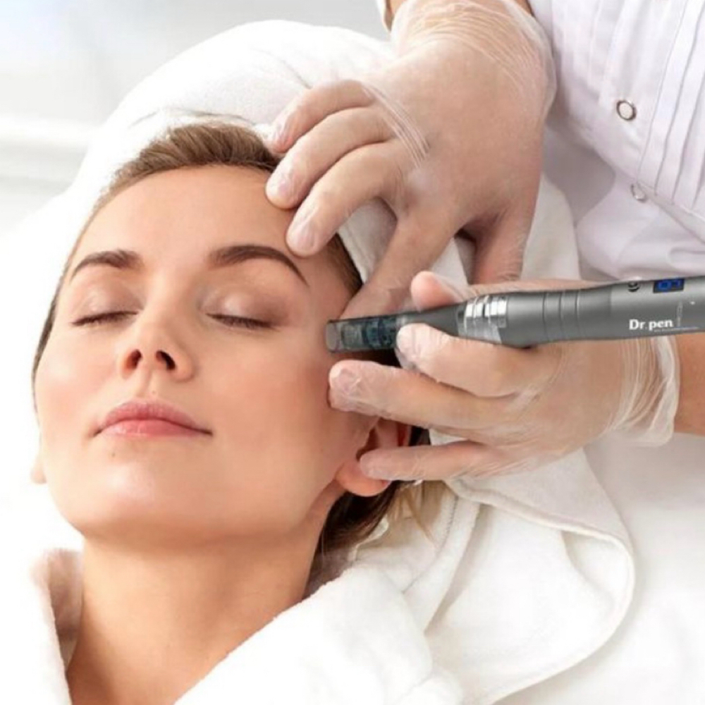 Microneedling at The Glow Studio by Lydia in Camas, WA