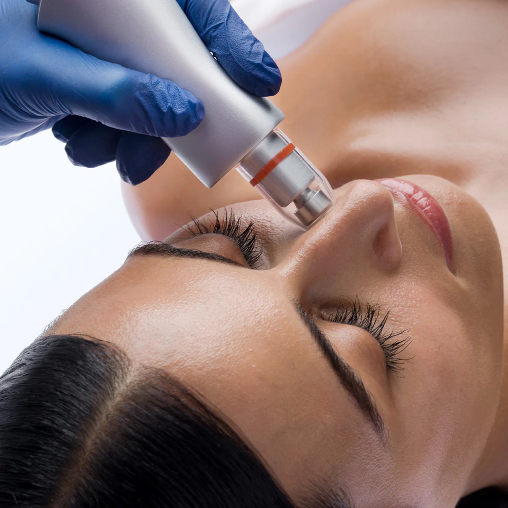 Add On Hydrodermabrasion at Soft Skin Studio in University Place, WA