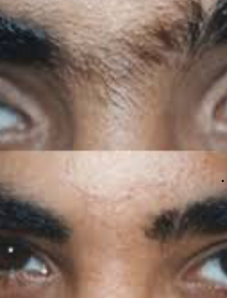 Unibrow(male/female)