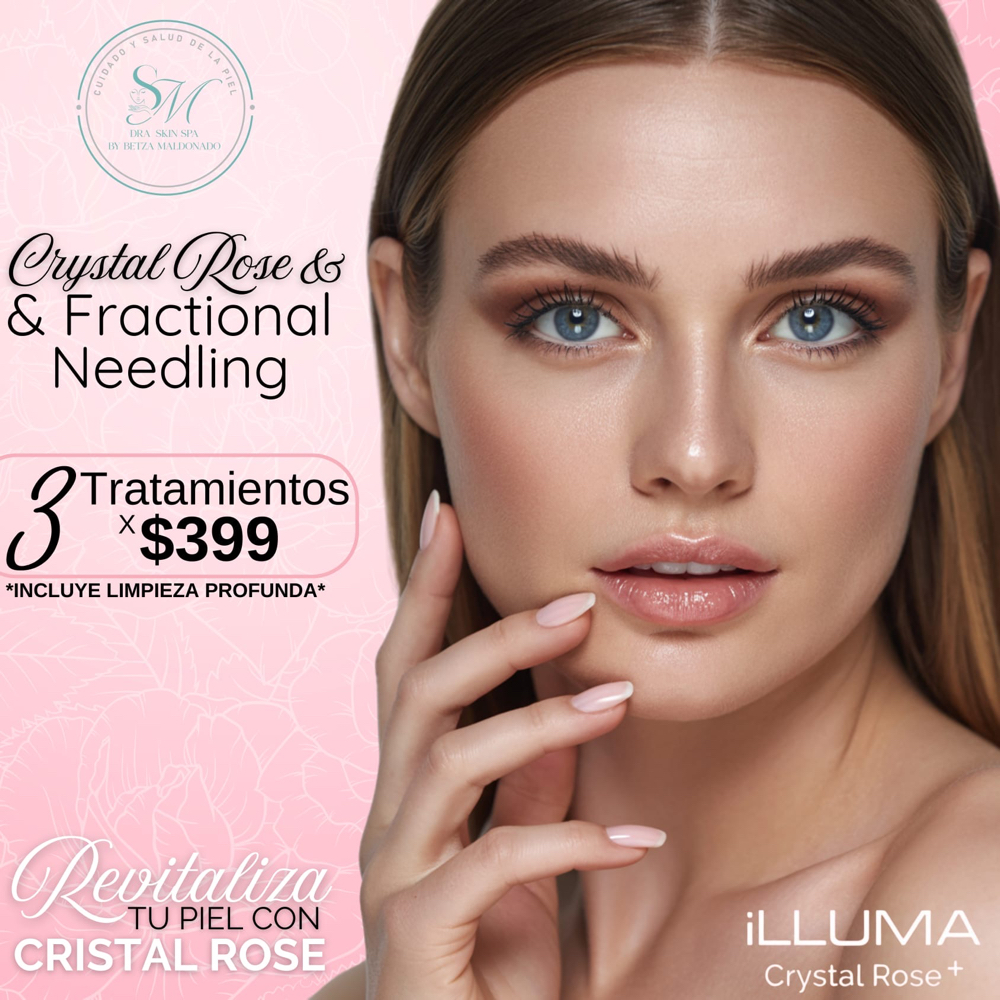 Illuma Mesohesl Treatment