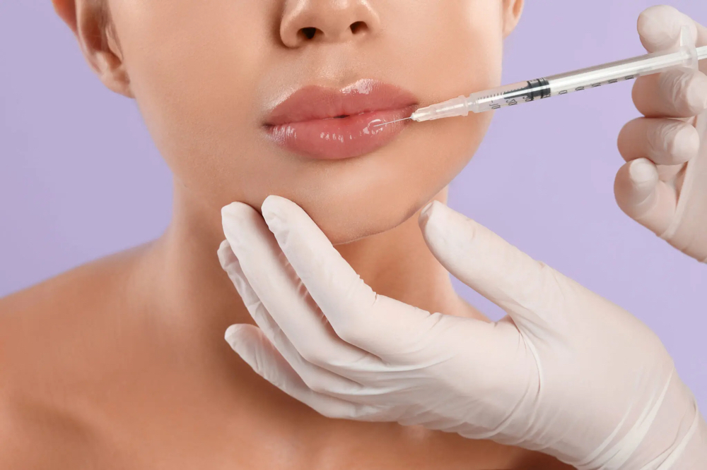 Dermal Filler (full Syringe)