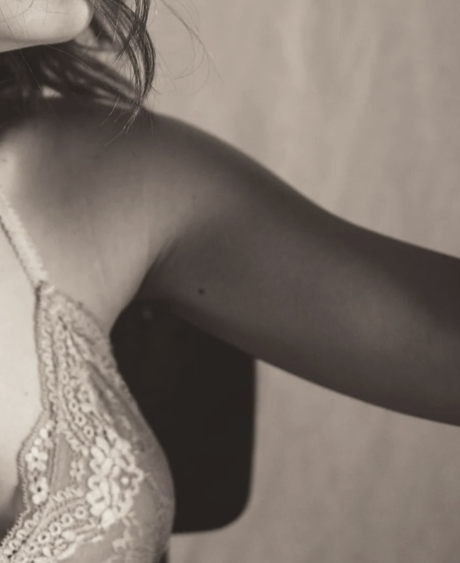 Laser Hair Removal - Underarms