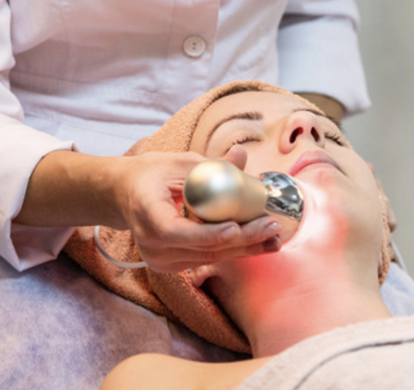 Acne Facial