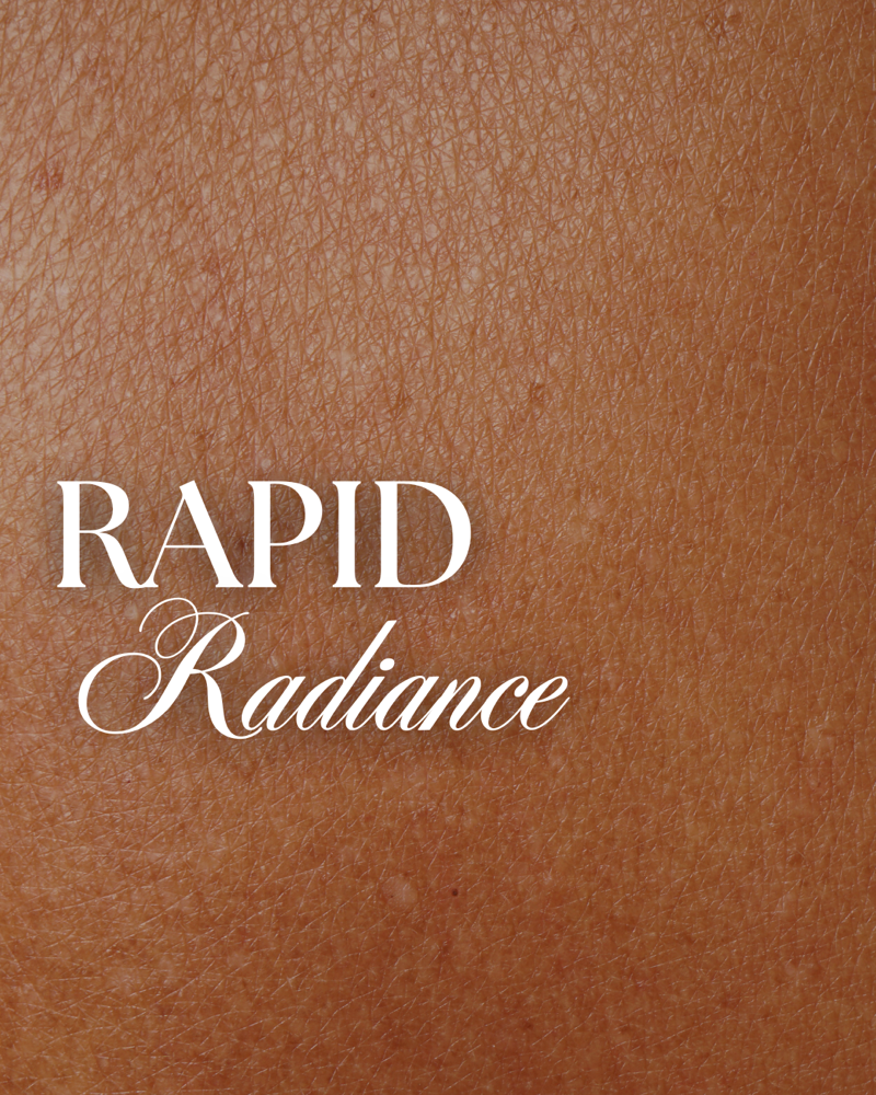 Rapid Radiance 🌞