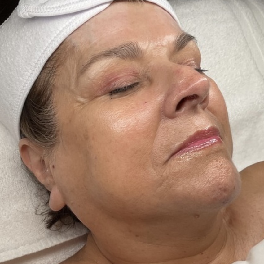 Illuminate Facial