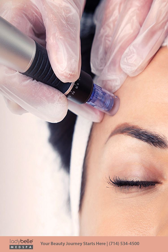 Collagen Infusion Package Of 3