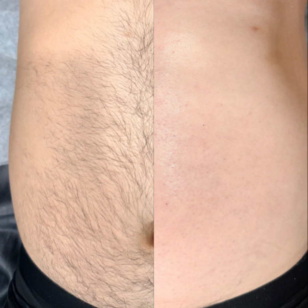 Mens Back OR Chest Wax at The Vanity Room in San Bernardino, CA