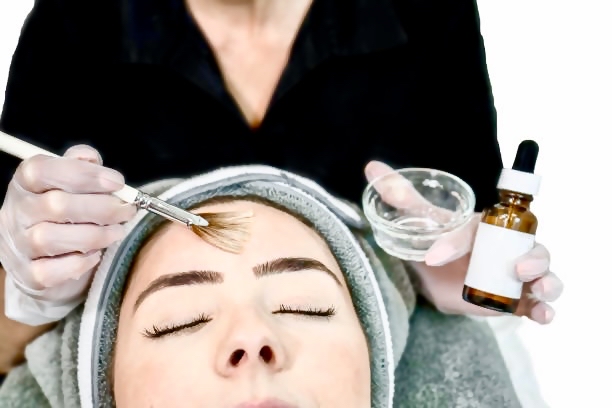 Chemical Peel