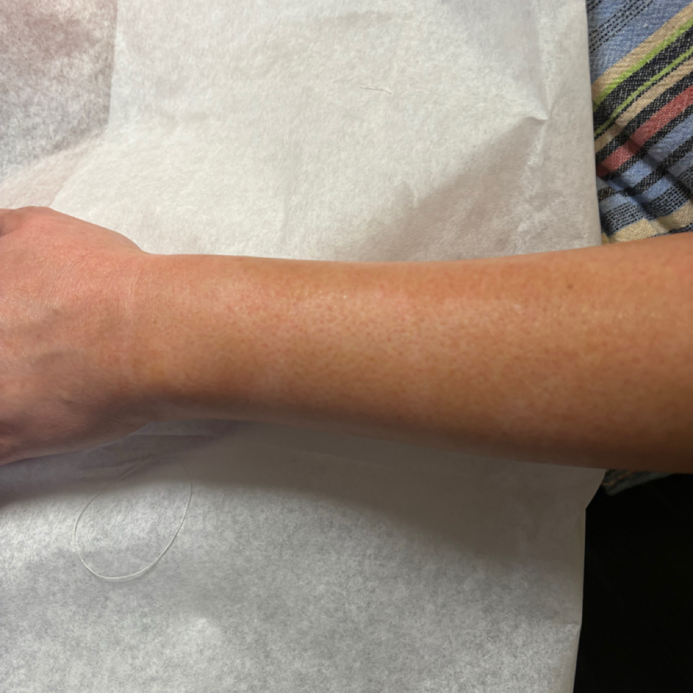 Full Arm Sugar at Poppy Esthetics in Wichita Falls, TX