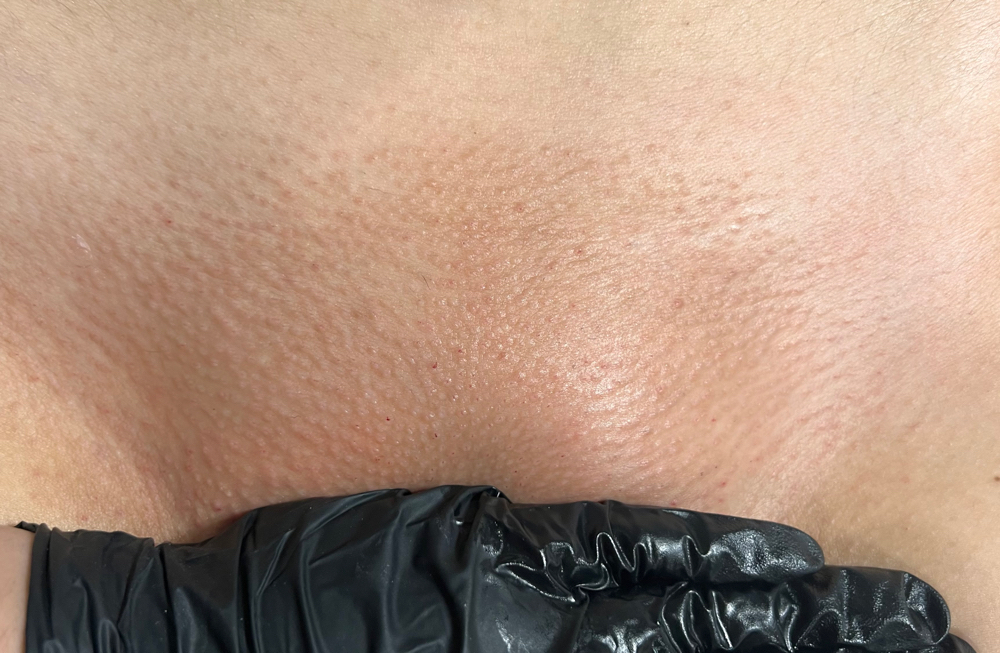 Brazilian Wax