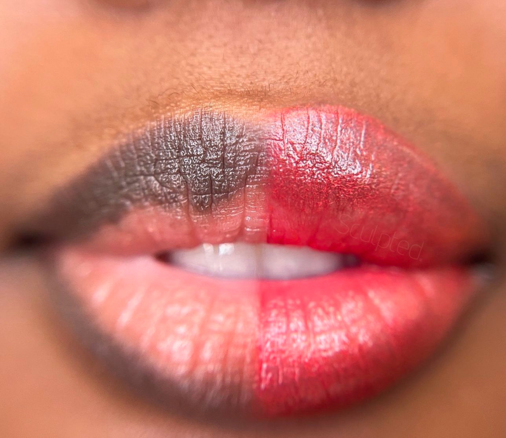 Dark Lips Brightening
