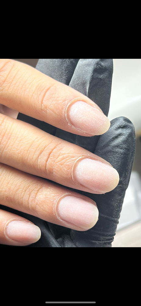 Structured Manicure Removal