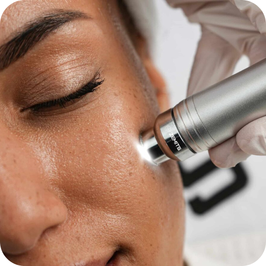 HydroDiamond/HydroFacial