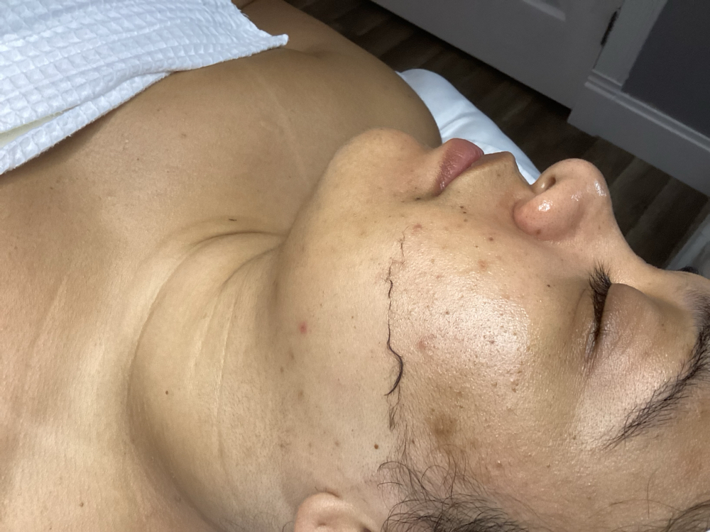 Express Dermaplane Facial