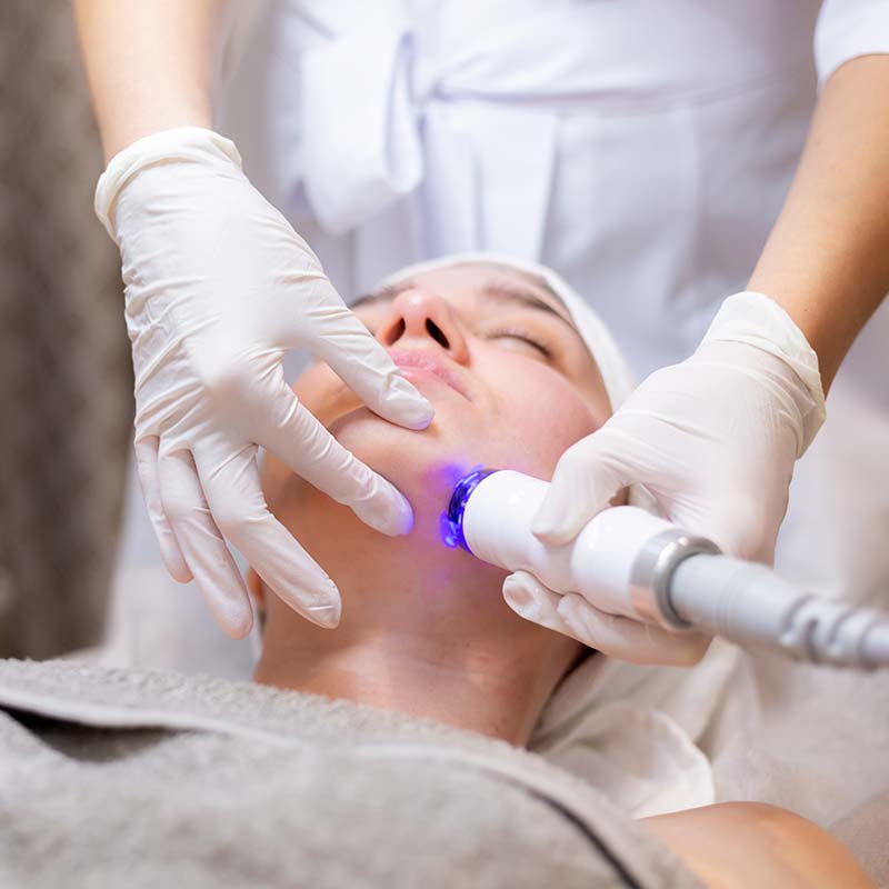 Acne Facial with High Frequency