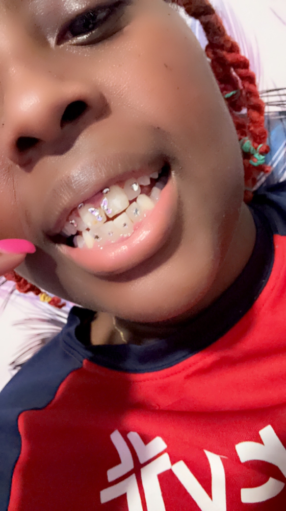 Teeth Gems at De-Stress Esthetics LLC in Saint Louis, MO